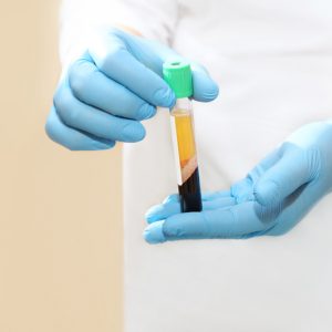 Medical test tube with blood and plasma in it being held by a gloved physician.