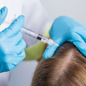 Patient sitting with head forward while a doctor injects hair regeneration liquid into scalp via syringe.