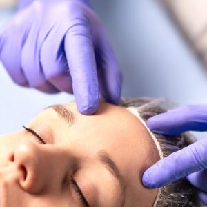 Young woman laying down for a cosmetic procedure while a gloved doctor points at her forehead.