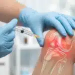 are-you-a-candidate-for-platelet-rich-plasma-prp-therapy
