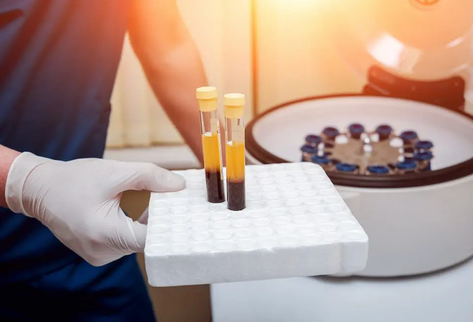 could-you-benefit-from-regenerative-medicine
