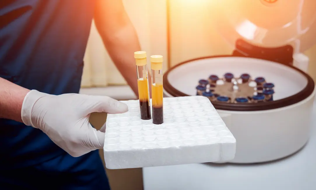 could-you-benefit-from-regenerative-medicine