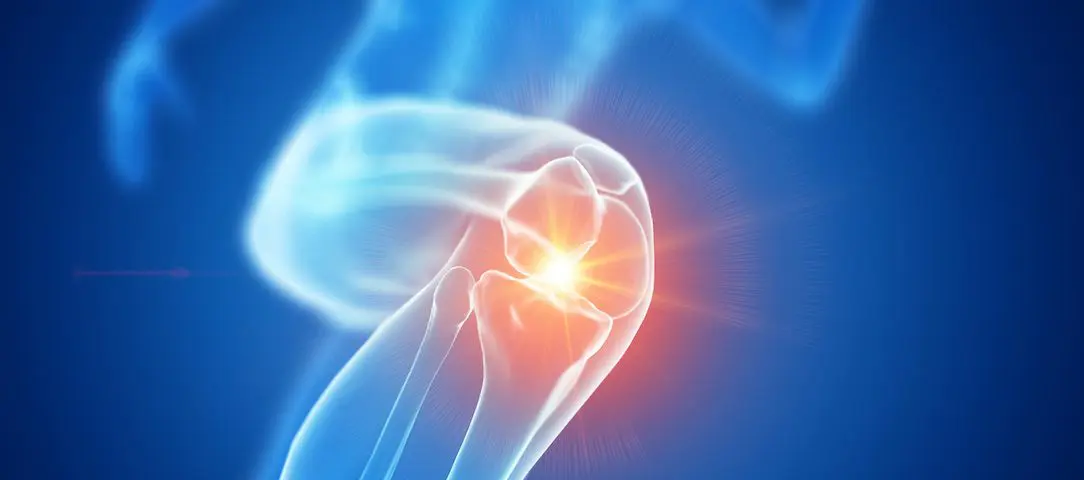 runners-knee-why-you-should-seek-help-first-sign-of-knee-pain
