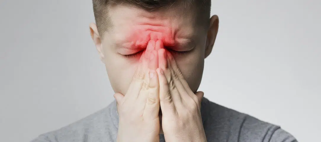 what-is-sinusitis
