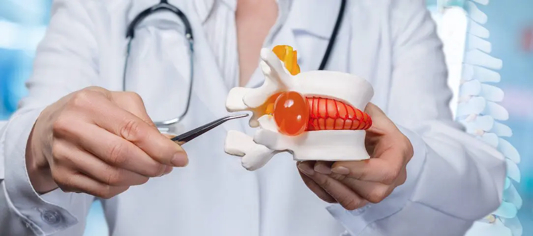 why-herniated-discs-happen